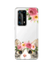Hey Casey! Floral Kitty Phone Case for iPhone Samsung Huawei