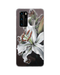 Hey Casey! Snow Lily Phone Case for iPhone Samsung Huawei