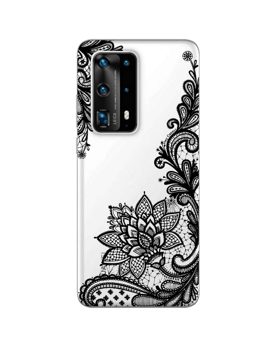 Hey Casey! Venetian Lace Phone Case for iPhone Samsung Huawei