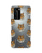 Hey Casey! Tiger Tiger Phone Case for iPhone Samsung Huawei