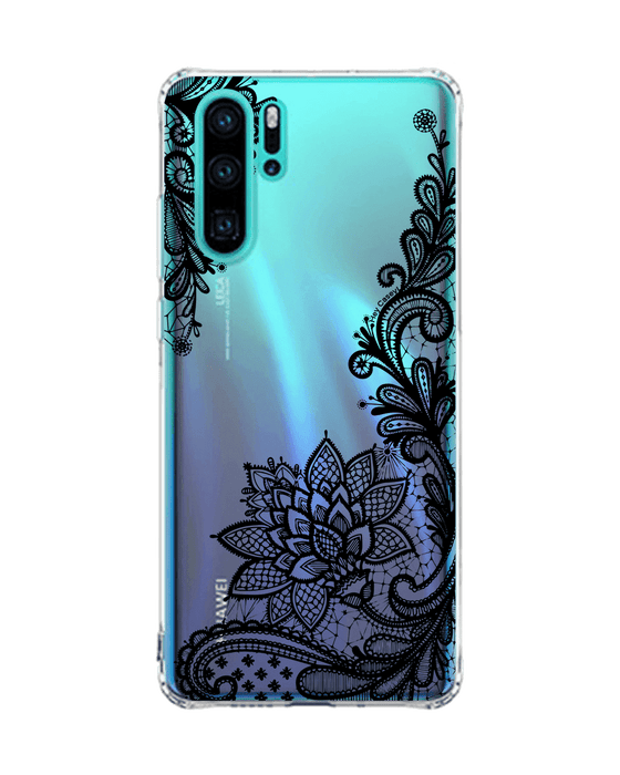 Hey Casey! Venetian Lace Phone Case for iPhone Samsung Huawei